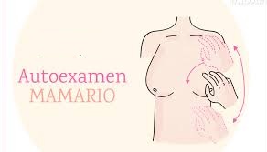 El autoexamen mamario